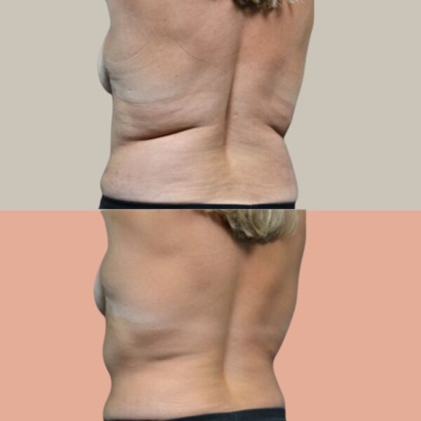 Cool Down + Tone Up