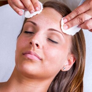 Chemical Peel Treatment