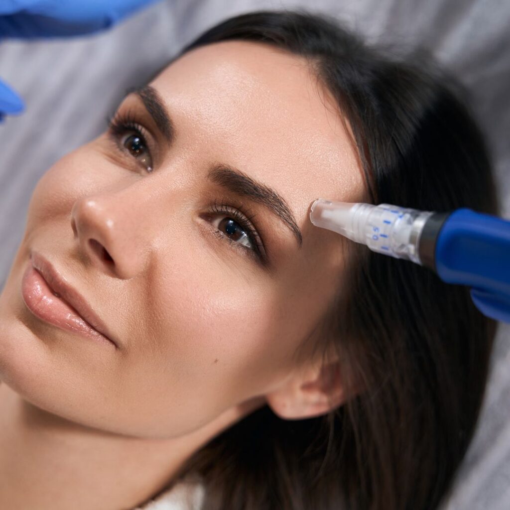 Microneedling